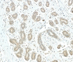 Novus Biologicals Rpn2 Antibody, Novus Biologicals 100 &mu;g, Unconjugated:Antibodies,