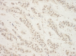 Novus Biologicals Folliculin Antibody, Novus Biologicals 100 &mu;g, Unconjugated:Antibodies,