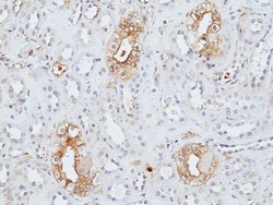 Novus Biologicals Uroplakin II Antibody (RM507), Novus Biologicals 100