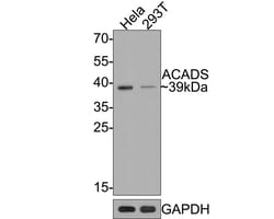 ACADS Antibody (JE64-13), Novus Biologicals 100 &mu;L; Unconjugated:Antibodies,