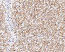 ACSL5 Antibody (A9D3-R), Novus Biologicals 100 &mu;L; Unconjugated:Antibodies,