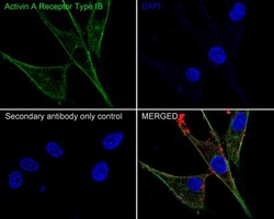 Activin RIB/ALK-4 Antibody (JE38-48), Novus Biologicals 100 &mu;L; Unconjugated:Antibodies,
