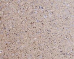 Activin RIB/ALK-4 Antibody (JE38-48), Novus Biologicals 100 &mu;L; Unconjugated:Antibodies,