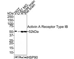 Activin RIB/ALK-4 Antibody (JE38-48), Novus Biologicals 100 &mu;L; Unconjugated:Antibodies,