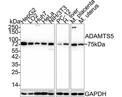 ADAMTS5 Antibody (PSH03-52), Novus Biologicals 100 &mu;L; Unconjugated:Antibodies,