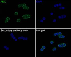 FDX1 Antibody (JE63-56), Novus Biologicals 100 &mu;L; Unconjugated:Antibodies,
