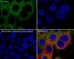 AHNAK Antibody (PSH01-11), Novus Biologicals 100 &mu;L; Unconjugated:Antibodies,