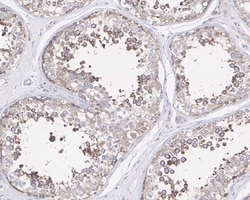 AIMP2 Antibody (PSH0-75), Novus Biologicals 100 &mu;L; Unconjugated:Antibodies,