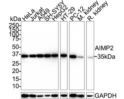 AIMP2 Antibody (PSH0-75), Novus Biologicals 100 &mu;L; Unconjugated:Antibodies,