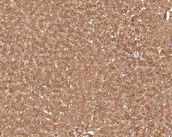 Aldehyde Oxidase 1/AOX1 Antibody (PSH0-17), Novus Biologicals 100 &mu;L;