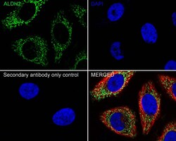 ALDH2 Antibody (E4-D10-R), Novus Biologicals 100 &mu;L; Unconjugated:Anticorps,