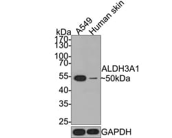 Aldehyde Dehydrogenase 3-A1/ALDH3A1 Antibody (PD00-73), Novus Biologicals 100 &mu;L | Buy Online | Novus Biologicals | Fisher Scientific