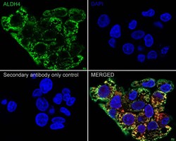 ALDH4A1 Antibody (7E2-R), Novus Biologicals 100 &mu;L; Unconjugated:Antibodies,