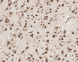 Aly Antibody (JE36-45), Novus Biologicals 100 &mu;L; Unconjugated:Antibodies,