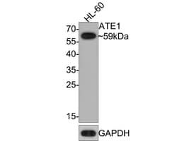 ATE1 Antibody (JE65-47), Novus Biologicals 100 &mu;L | Buy Online | Novus Biologicals | Fisher Scientific