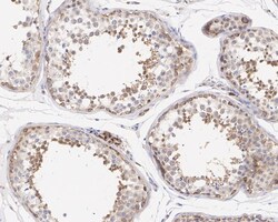 ATG4C Antibody (JE59-99), Novus Biologicals 100 &mu;L; Unconjugated:Antibodies,