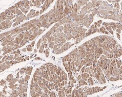 Sodium Potassium ATPase Alpha 2 Antibody (JE34-00), Novus Biologicals 100