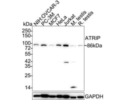 ATRIP Antibody (JE54-71), Novus Biologicals 100 &mu;L; Unconjugated:Antikörper