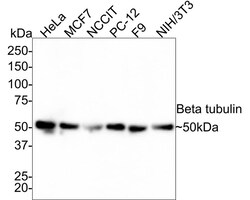 beta Tubulin Antibody (1-B11-R), Novus Biologicals 100 &mu;L; Unconjugated:Antikörper