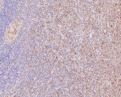 beta Tubulin Antibody (1-B11-R), Novus Biologicals 100 &mu;L; Unconjugated:Antikörper