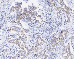 BMP-4 Antibody (JE42-44), Novus Biologicals 100 &mu;L; Unconjugated:Antibodies,