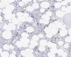 BNIP3L Antibody (JE59-98), Novus Biologicals 100 &mu;L; Unconjugated:Antibodies,