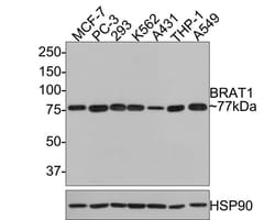 BAAT1 Antibody (JE64-71), Novus Biologicals 100 &mu;L; Unconjugated:Antibodies,