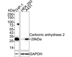 Carbonic Anhydrase II/CA2 Antibody (11A2-R), Novus Biologicals 100 &mu;L;