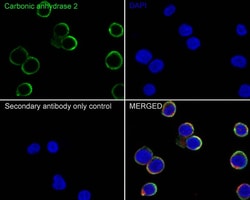 Carbonic Anhydrase II/CA2 Antibody (11A2-R), Novus Biologicals 100 &mu;L;