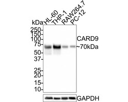 CARD9 Antibody (PSH0-41), Novus Biologicals 100 &mu;L; Unconjugated:Antibodies,