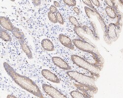 CBLB Antibody (PSH03-49), Novus Biologicals 100 &mu;L; Unconjugated:Antibodies,