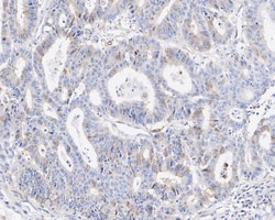 RHAMM/CD168 Antibody (PSH02-16), Novus Biologicals 100 &mu;L; Unconjugated:Antibodies,