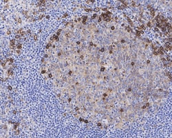CD38 Antibody (PD01-49), Novus Biologicals 100 &mu;L | Buy Online | Novus Biologicals | Fisher Scientific