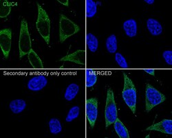 CLIC4 Antibody (JE65-09), Novus Biologicals 100 &mu;L; Unconjugated:Antibodies,