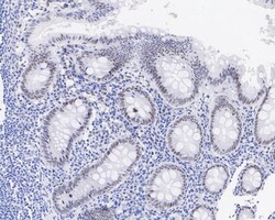 RCOR1/CoREST Antibody (JE35-15), Novus Biologicals 100 &mu;L; Unconjugated:Antibodies,
