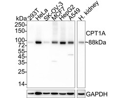 CPT1A Antibody (PSH04-00), Novus Biologicals 100 &mu;L; Unconjugated:Antibodies,