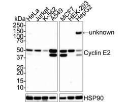 Cyclin E2 Antibody (40-89-R), Novus Biologicals 100 &mu;L; Unconjugated:Antibodies,
