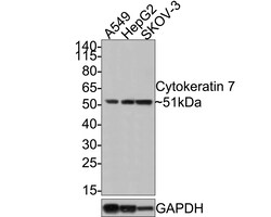 Cytokeratin 7 Antibody (3-G3-D8-R), Novus Biologicals 100 &mu;L; Unconjugated:Anticuerpos