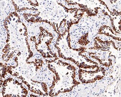 Cytokeratin 7 Antibody (3-G3-D8-R), Novus Biologicals 100 &mu;L; Unconjugated:Anticuerpos