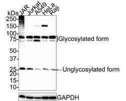 TRAILR3/TNFRSF10C Antibody (JE58-51), Novus Biologicals 100 &mu;L; Unconjugated:Antibodies,