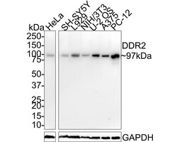 DDR2 Antibody (JE31-45), Novus Biologicals 100 &mu;L; Unconjugated:Antibodies,
