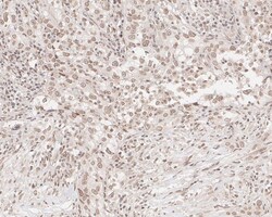 UBR5/EDD Antibody (JE38-53), Novus Biologicals 100 &mu;L; Unconjugated:Antibodies,