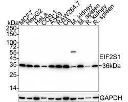 eIF2 alpha/EIF2S1 Antibody (PSH04-29), Novus Biologicals 100 &mu;L; Unconjugated:Antibodies,