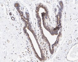 eIF2 alpha/EIF2S1 Antibody (PSH04-29), Novus Biologicals 100 &mu;L; Unconjugated:Antibodies,