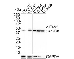 eIF4A2 Antibody (PSH01-88), Novus Biologicals 100 &mu;L; Unconjugated:Antibodies,