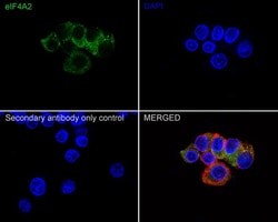 eIF4A2 Antibody (PSH01-88), Novus Biologicals 100 &mu;L; Unconjugated:Antibodies,