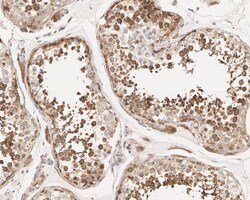 eIF4A2 Antibody (PSH01-88), Novus Biologicals 100 &mu;L; Unconjugated:Antibodies,