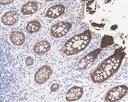EpCAM/TROP1 Antibody (PS01-69), Novus Biologicals 100 &mu;L; Unconjugated:Antibodies,