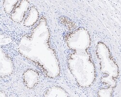 HNF-3 alpha/FoxA1 Antibody (A2E8-R), Novus Biologicals 100 &mu;L; Unconjugated:Antibodies,