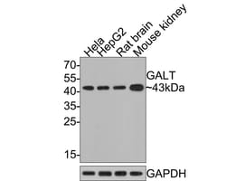 GALT Antibody (JE64-66), Novus Biologicals 100 &mu;L; Unconjugated:Antibodies,
